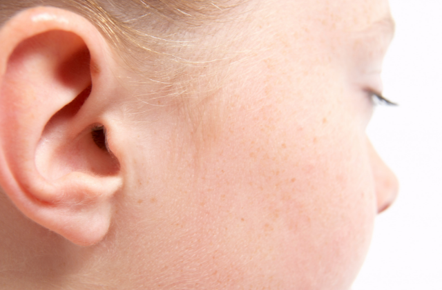 Odstające uszy u dzieci korekta uszu w Derm Estetyka
